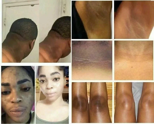 Skin lightening cream for - skin,