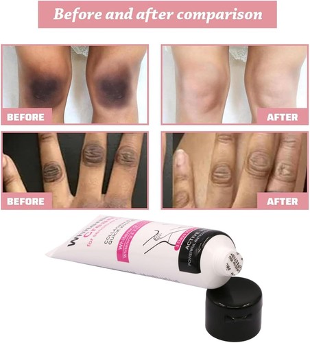 Underarm whitening - underarm,