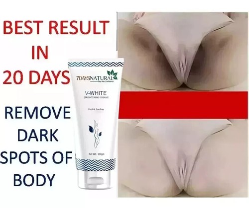 Whitening cream 100 gm - 100, free
