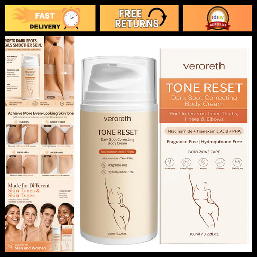 Whitening cream dark spot - cream,