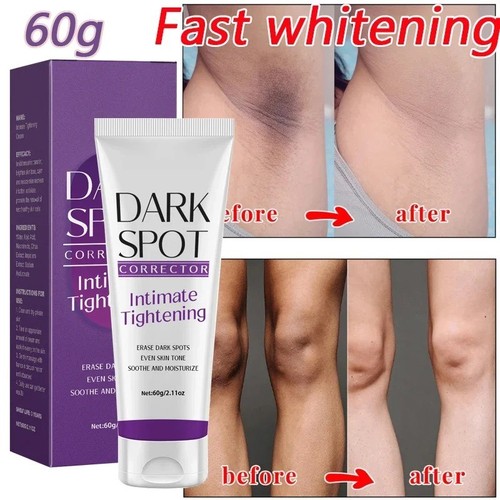 Body whitening cream underarm - body,