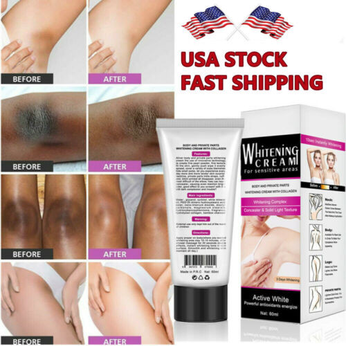 Skin whitening cream - skin,