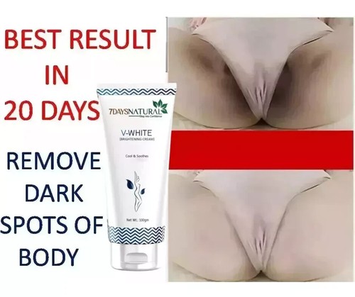 Whitening cream 100 gm - -, free