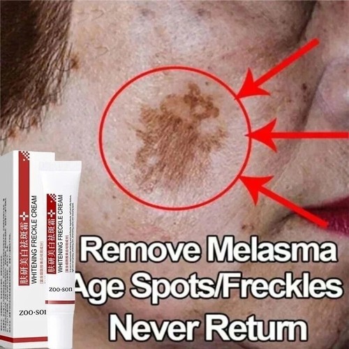 Powerful spot removing - spot-removing, whiten