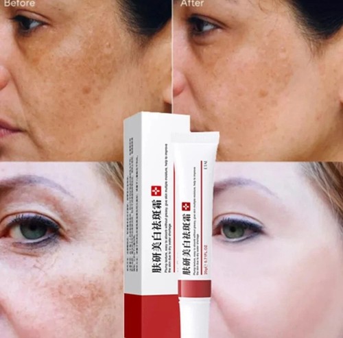 2pcs whitening freckle cream - 2pcs,