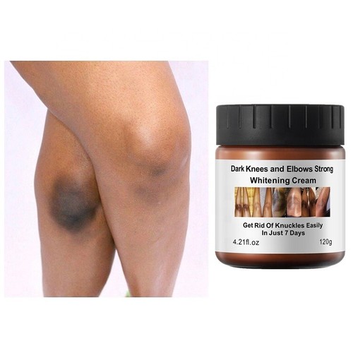 New strong whitening cream - strong,