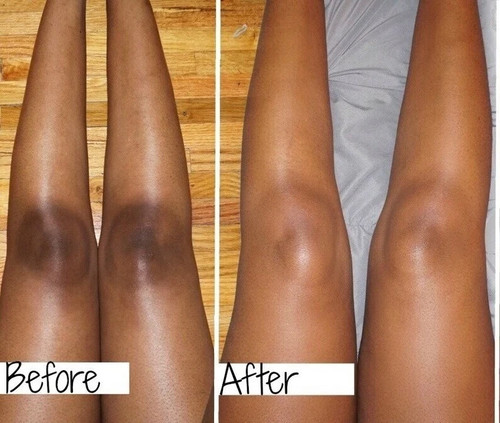 New strong whitening cream - new,