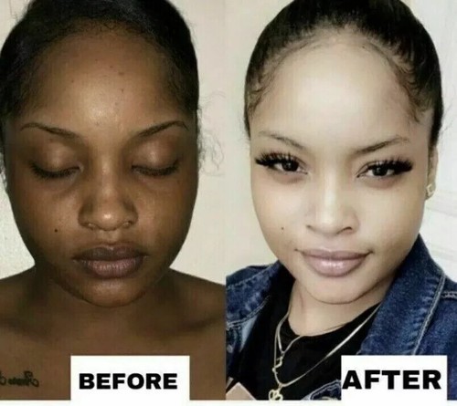 Skin lightening cream extra - 3*skin,