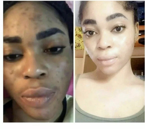Dark skin bleaching cream - dark,